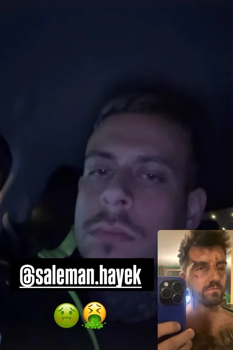 Rišo po zranení prelomil mlčanie: Miša, Majo a Igor posielajú odkazy Slovákom 5 Rišo bitka Majo